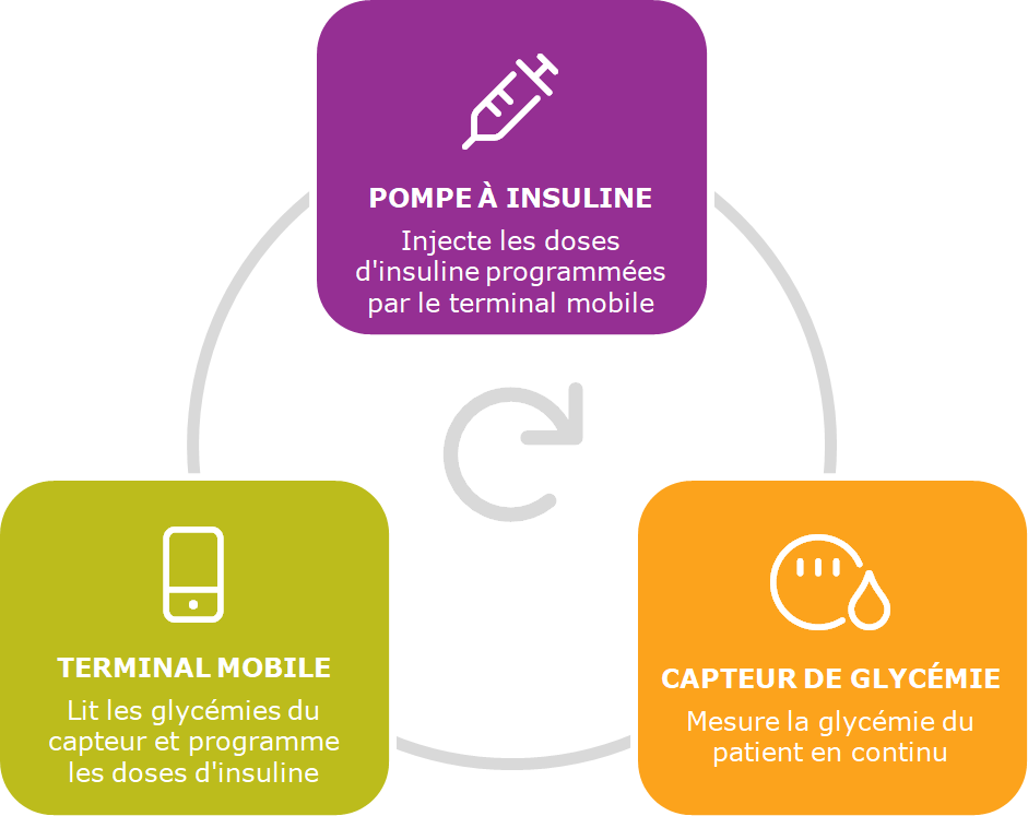 Système d'injection automatique d'insuline en "boucle fermée"